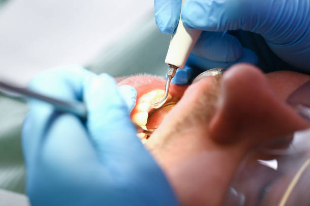 Best Emergency Dental Care for Trauma or Injury in Maricopa, CA